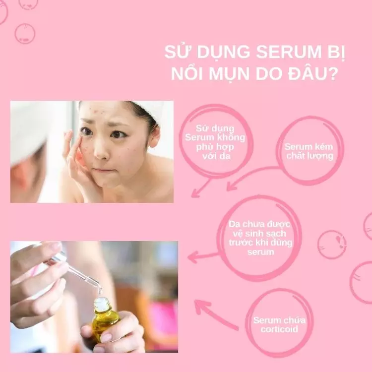 Sử dụng serum nổi mụn nguyên nhân do đâu