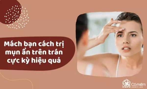 cách trị mụn ẩn trên trán