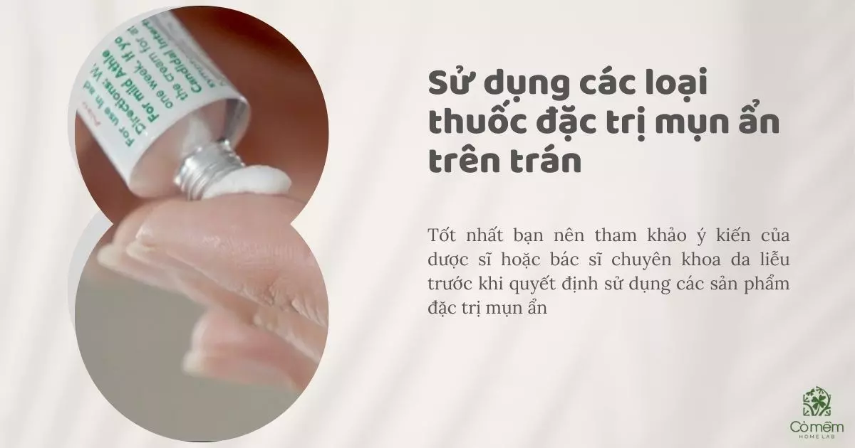 cách trị mụn ẩn trên trán