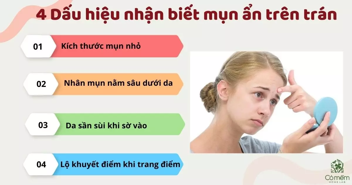 cách trị mụn ẩn trên trán