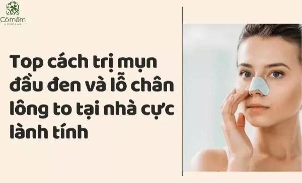 cách trị mụn đầu đen và lỗ chân lông to