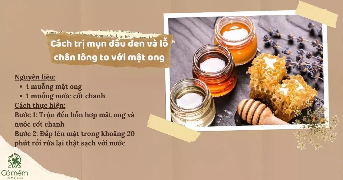 cách trị mụn đầu đen và lỗ chân lông to