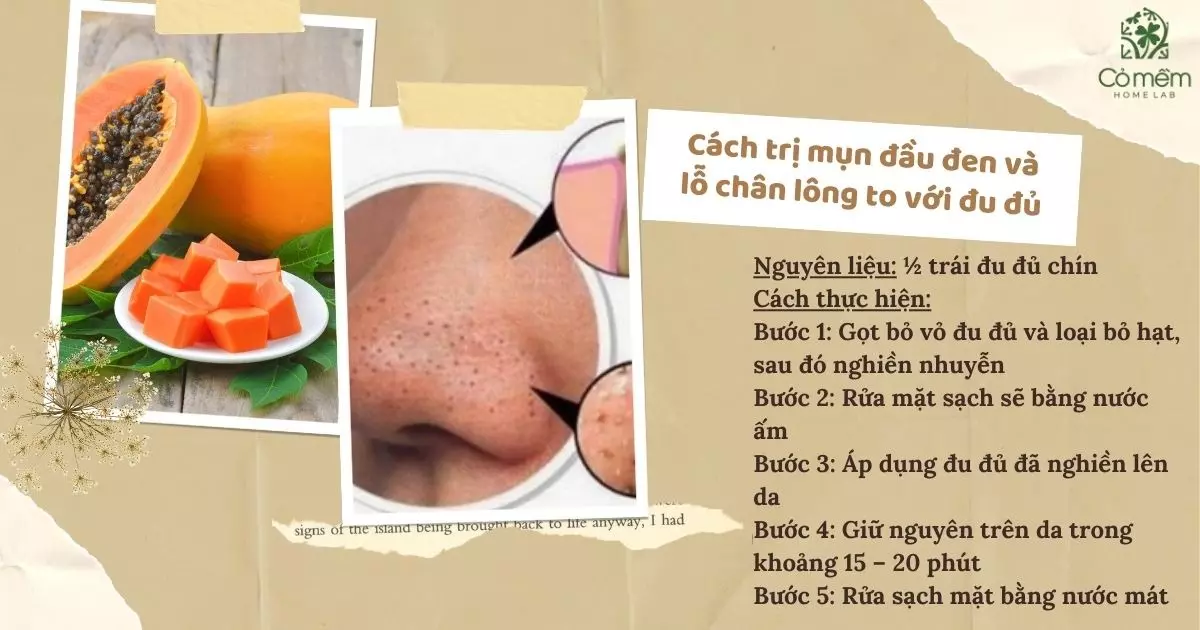 cách trị mụn đầu đen và lỗ chân lông to