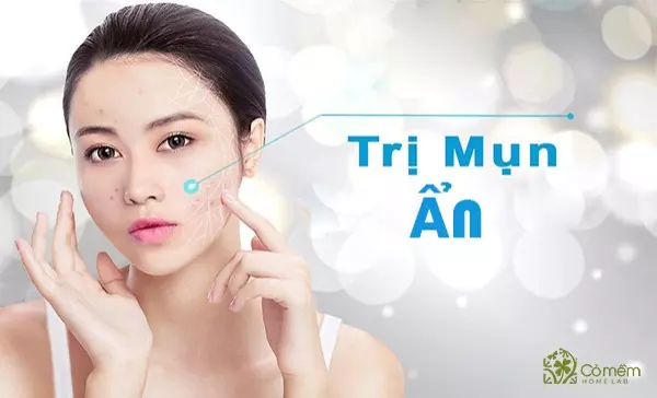 trị mụn ẩn