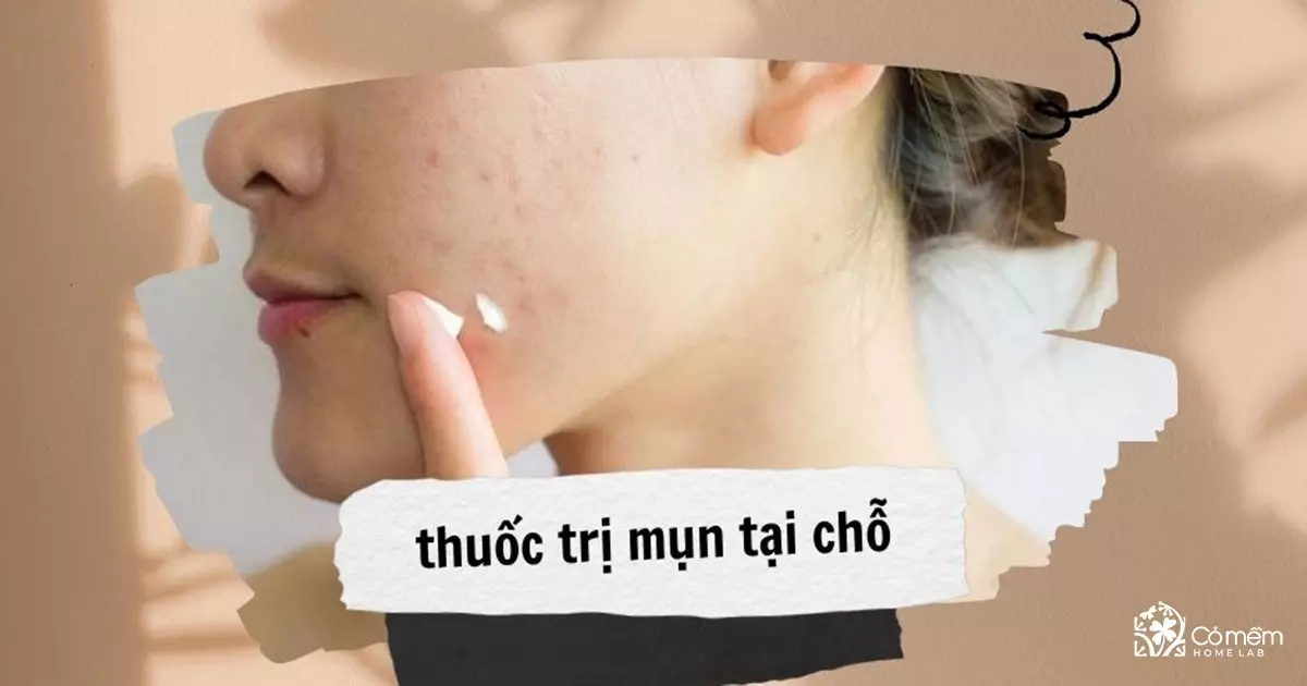 trị mụn ẩn