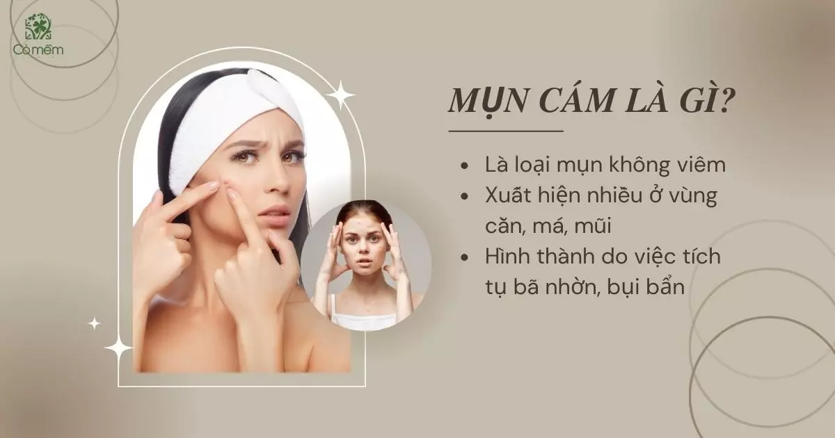 trị mụn cám