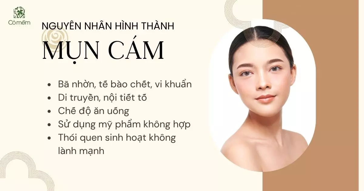 trị mụn cám