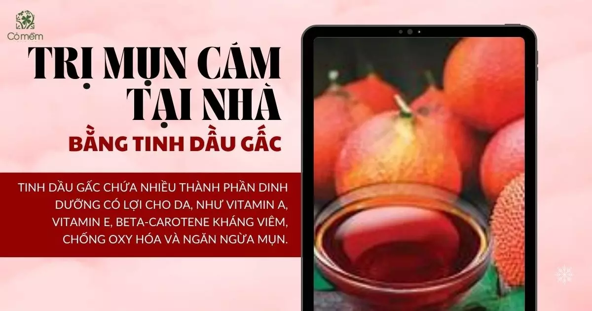 trị mụn cám