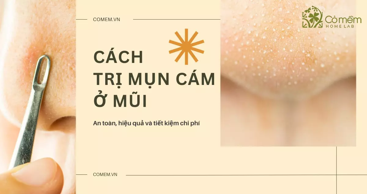 8+ Cách trị mụn cám ở mũi hiệu quả cho làn da sáng mịn