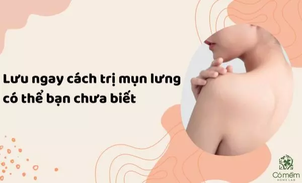 trị mụn lưng