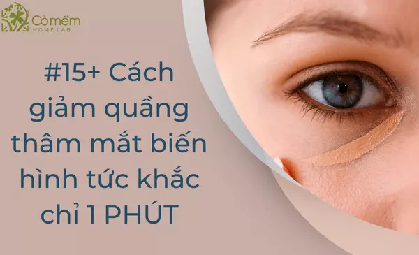 #15+ Cách giảm quầng thâm mắt biến hình tức khắc chỉ 1 PHÚT