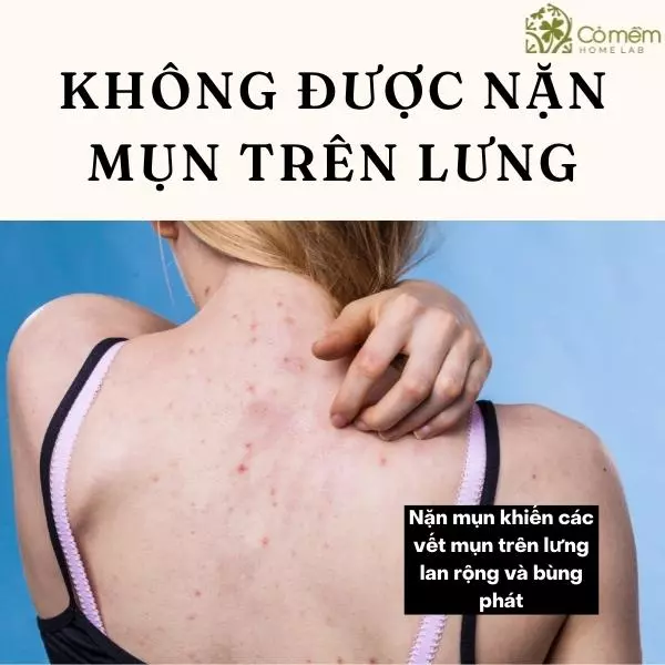 trị mụn và vết thâm ở lưng nhanh nhất