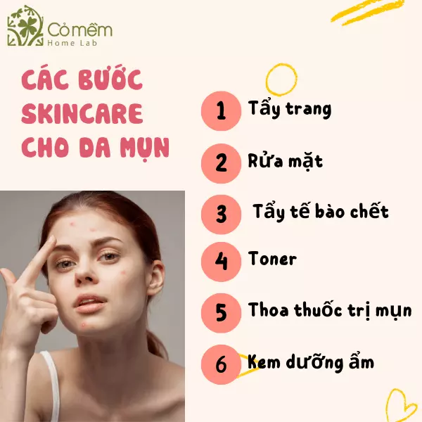 các bước skincare ban đêm cho da mụn