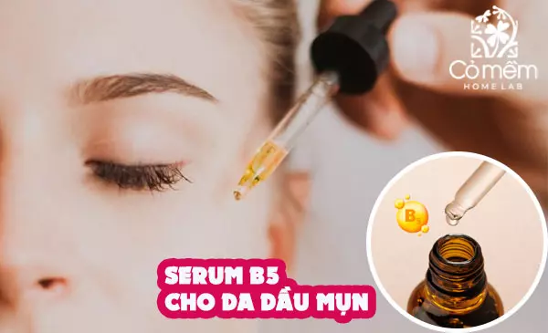 serum b5 cho da dầu mụn