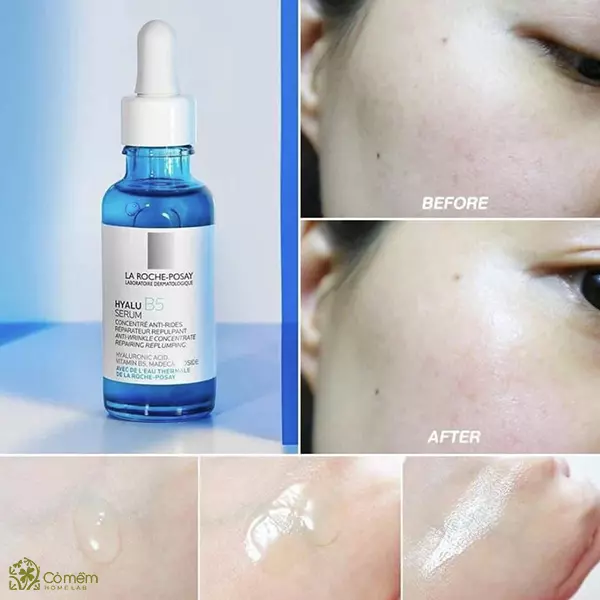 serum b5 trị nám tàn nhang