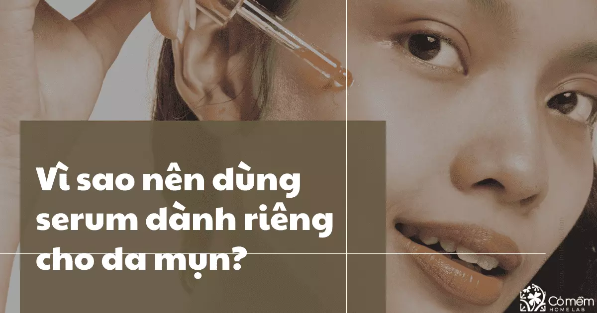 serum cho da mụn