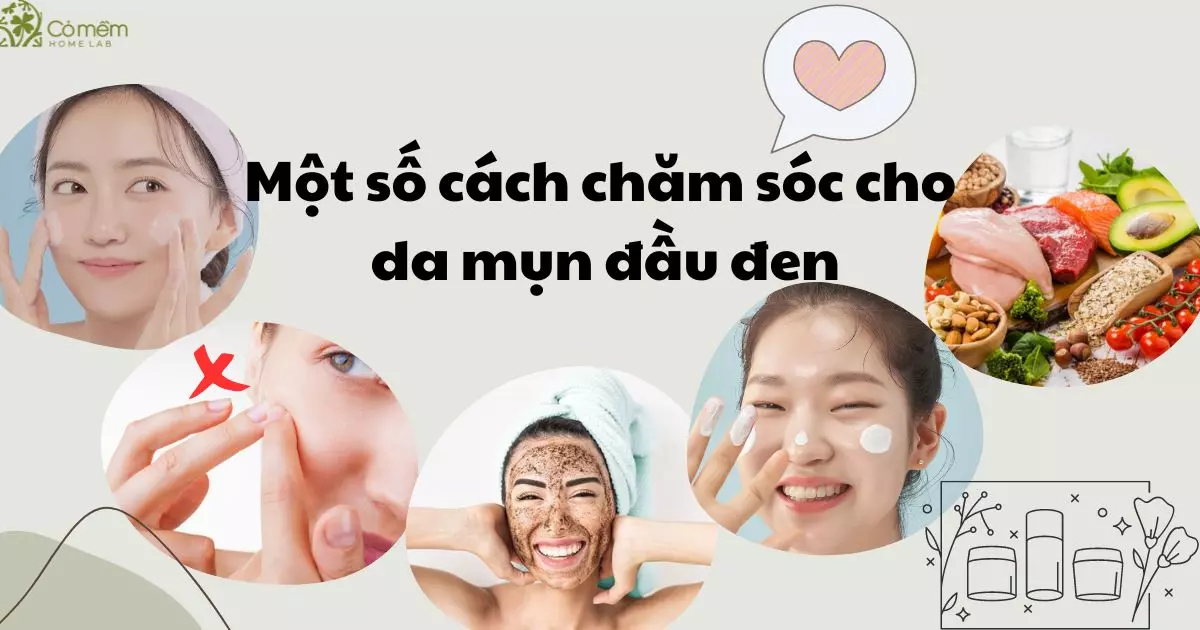 sữa rửa mặt trị mụn đầu đen