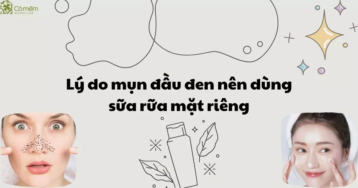 sữa rửa mặt trị mụn đầu đen